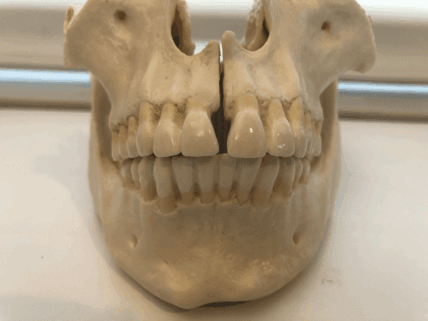 craniofacial development