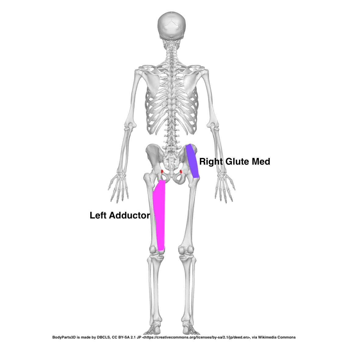Left Adductor Right Glute Med