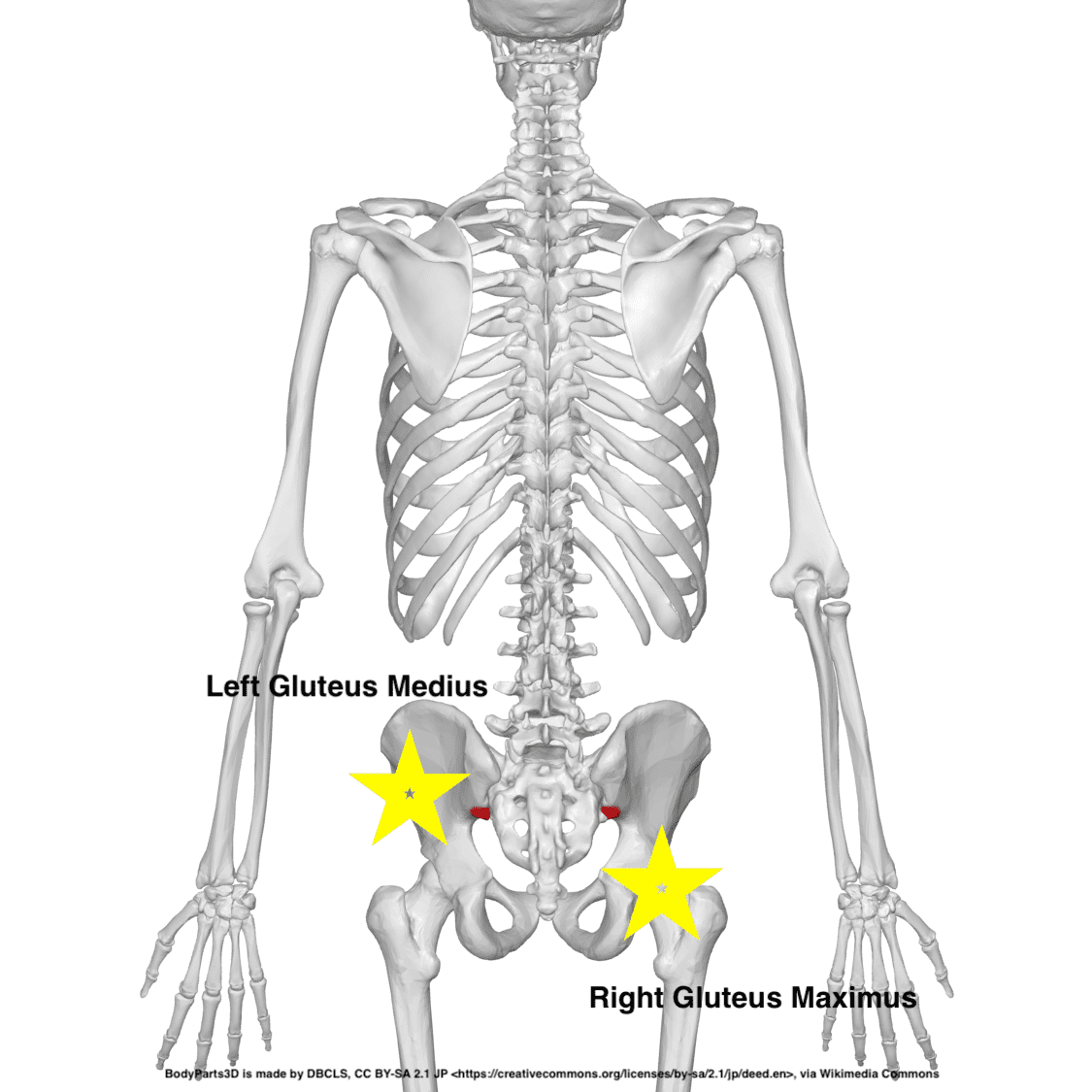 Left glute med, right glut max